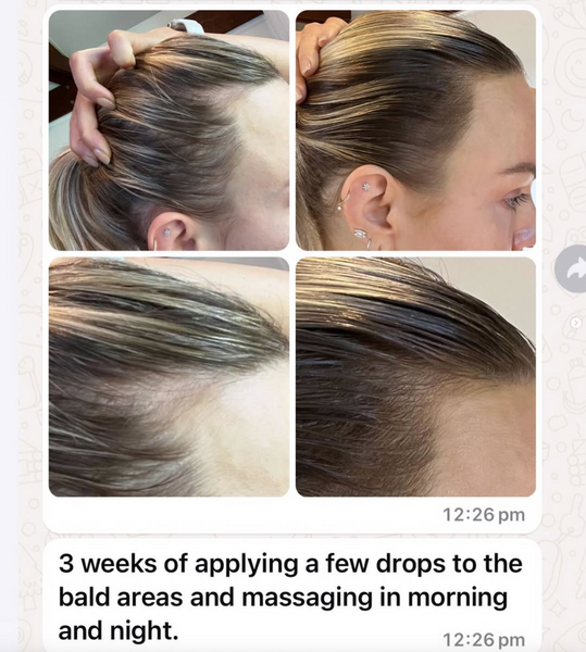 Vita-Growth Scalp Serum – Image 4